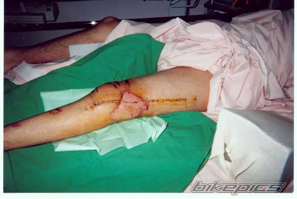 Bike Photo 13434