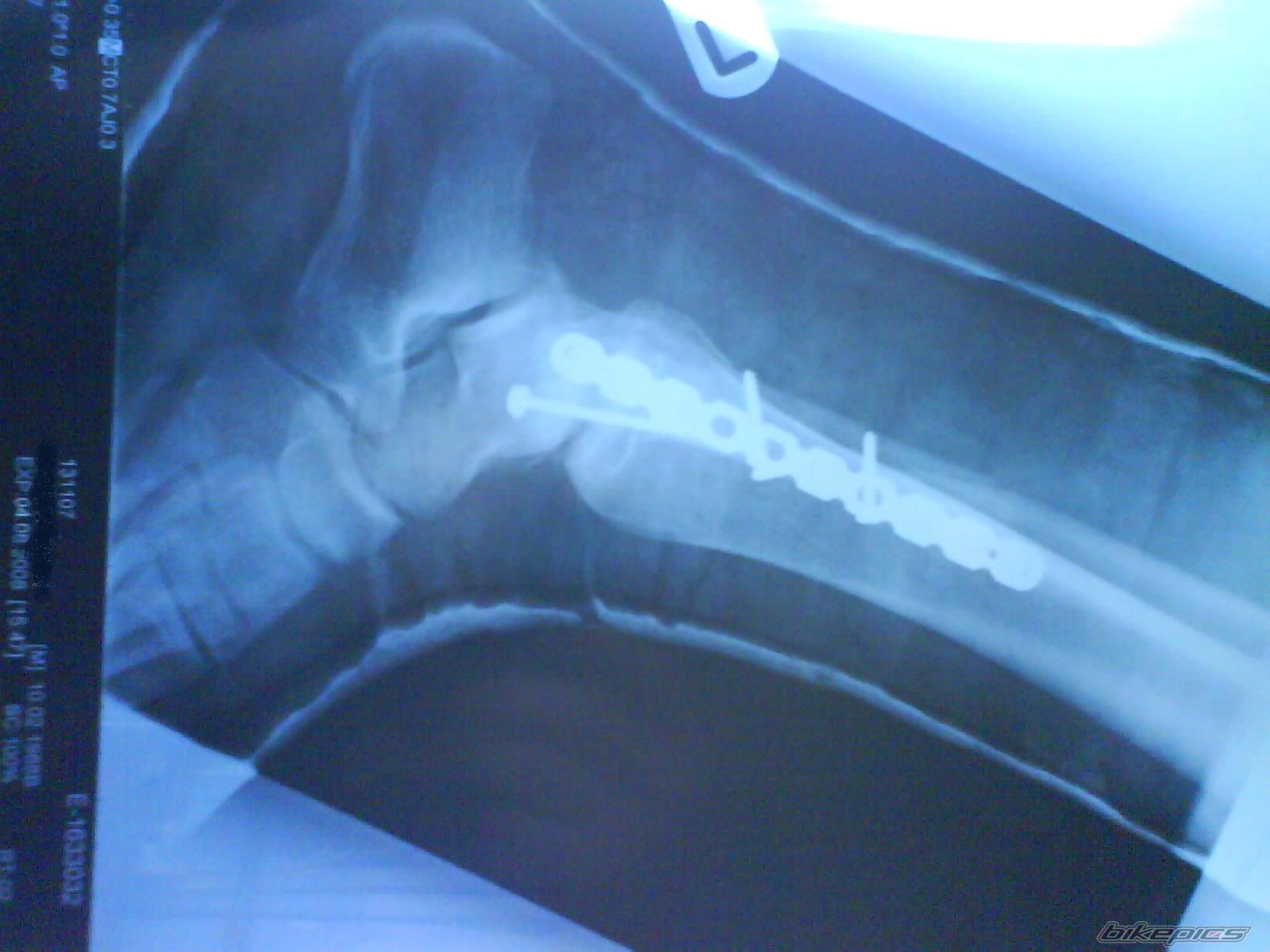 Photo 1378876