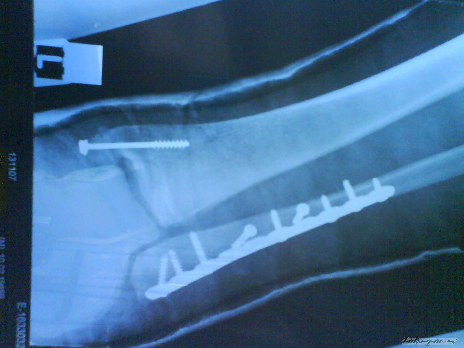 Photo 1378877