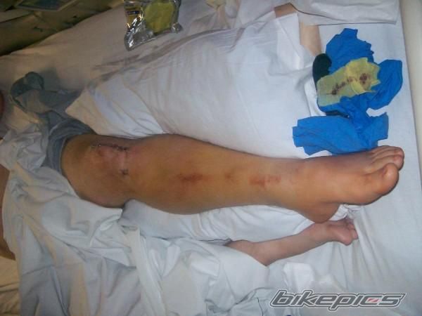 Photo 1511212