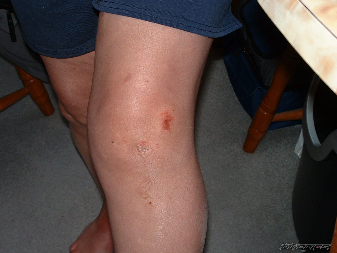 Photo 1711785