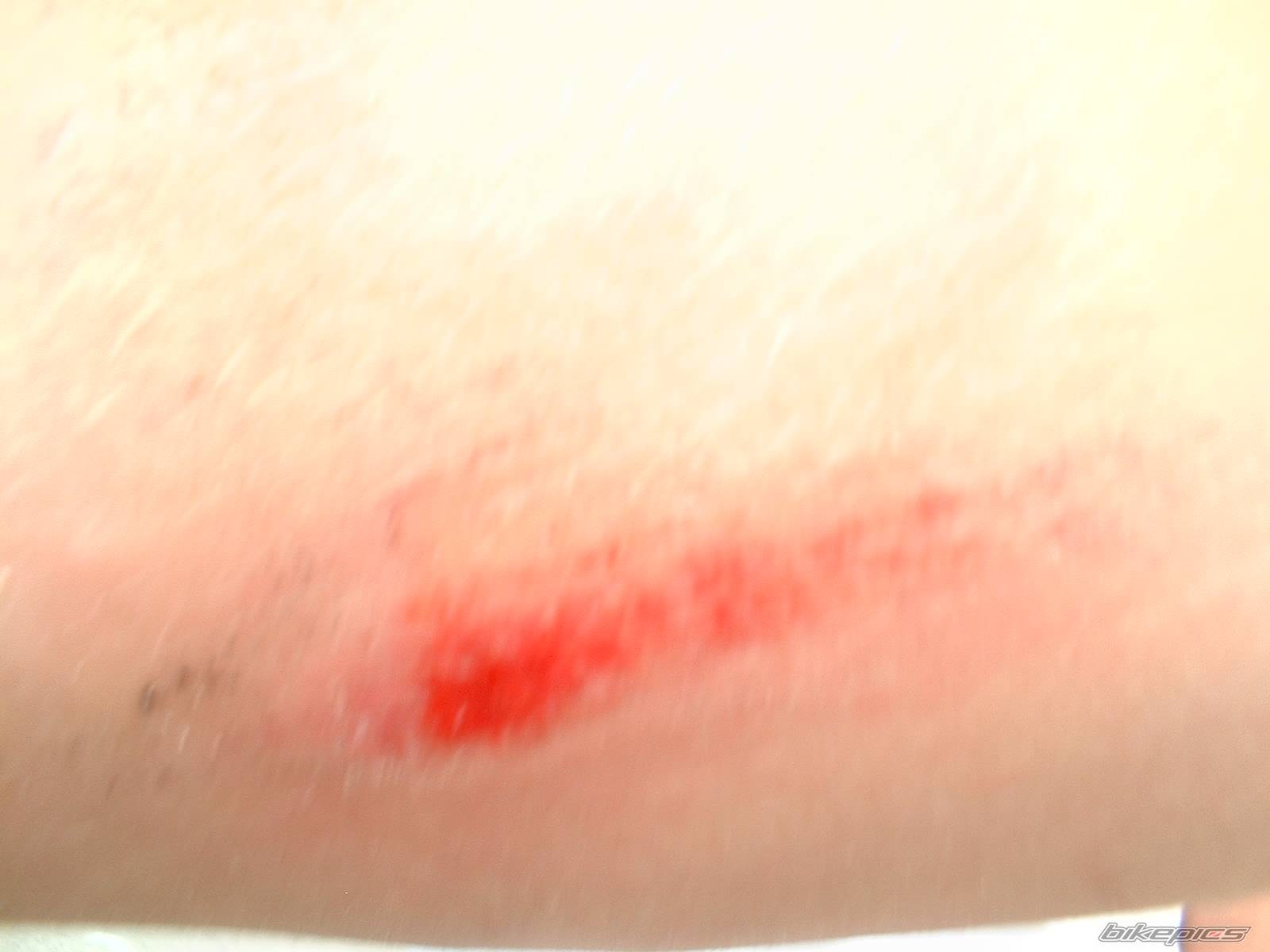 Photo 177288