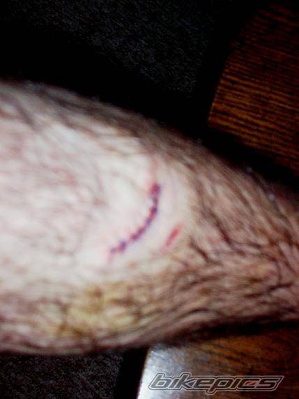 Photo 194992