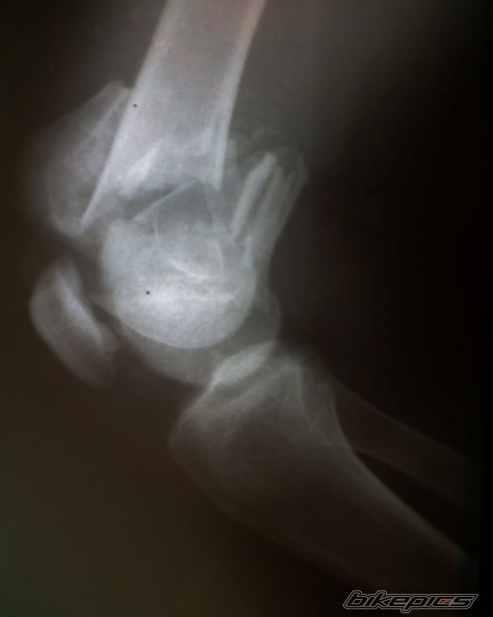 Photo 2079175