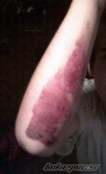 Photo 217257