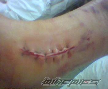 Bike Photo 235798