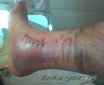 Bike Photo 235801