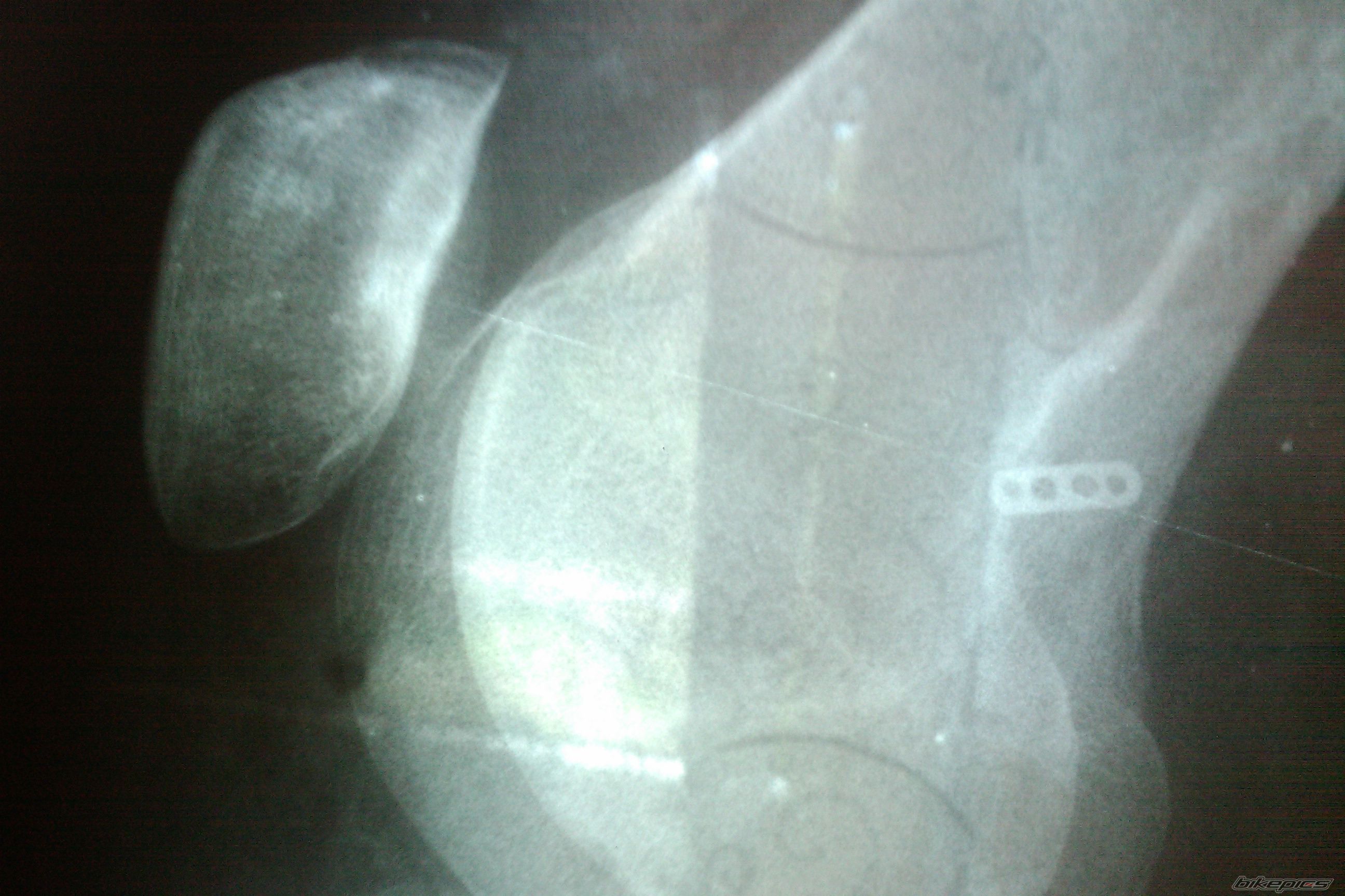 Photo 2408886