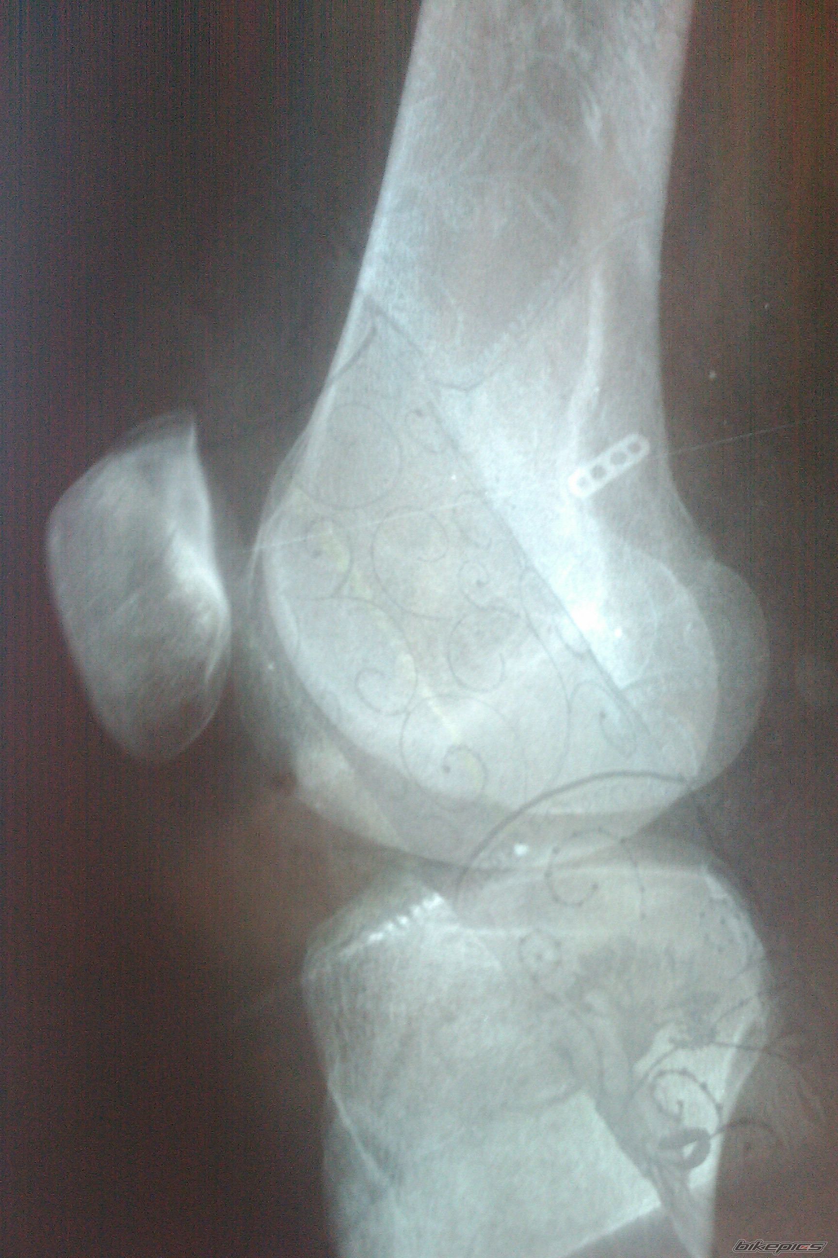 Photo 2408887