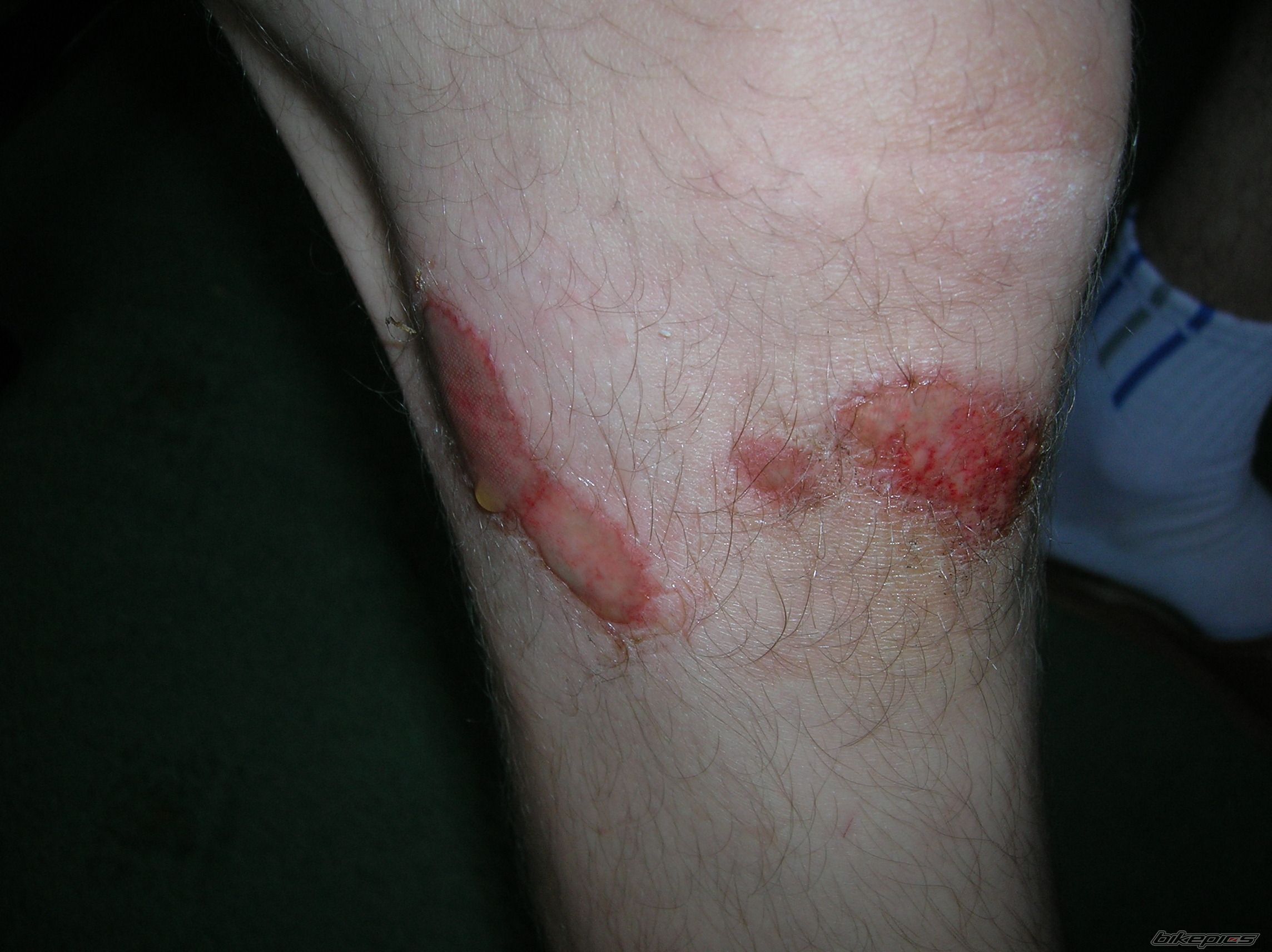 Photo 2433723