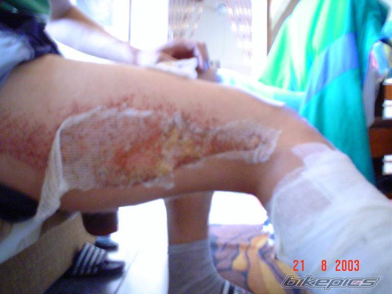 Photo 252210