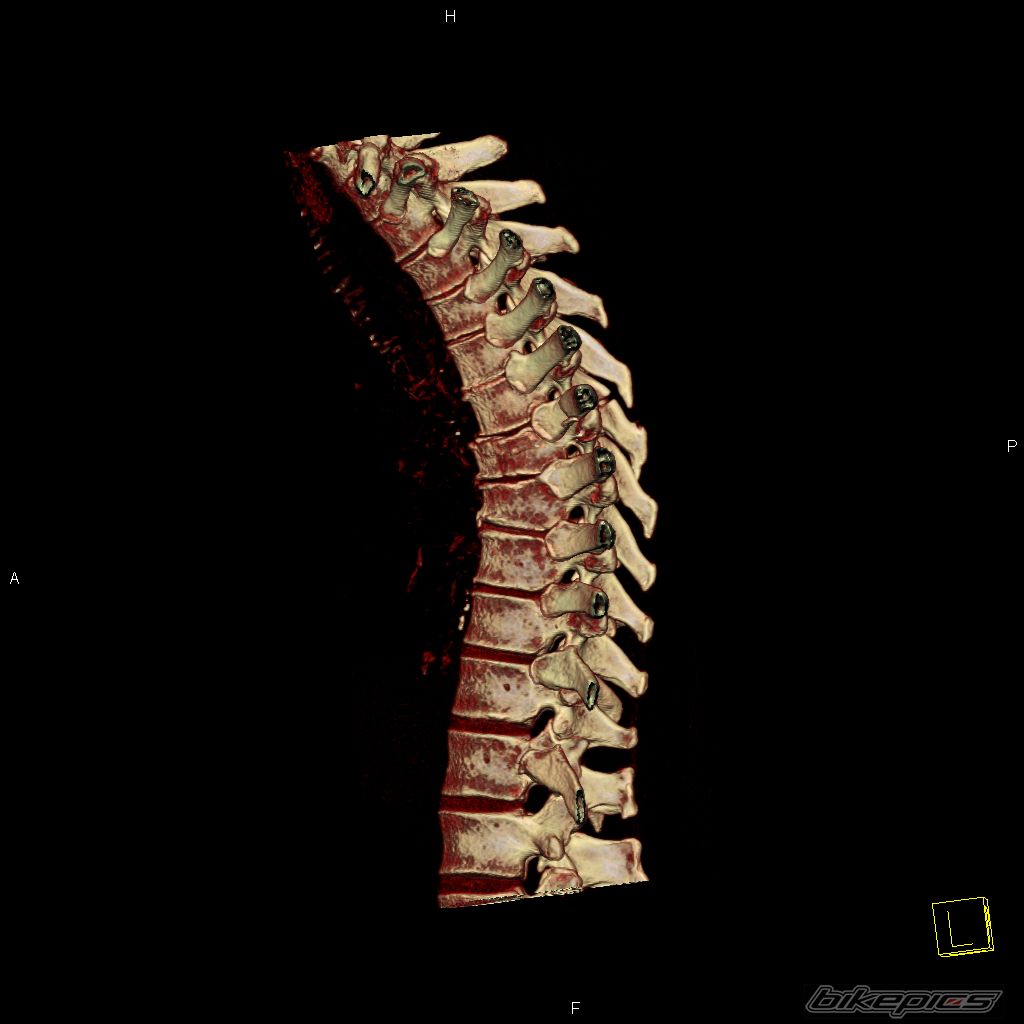 Photo 2584891