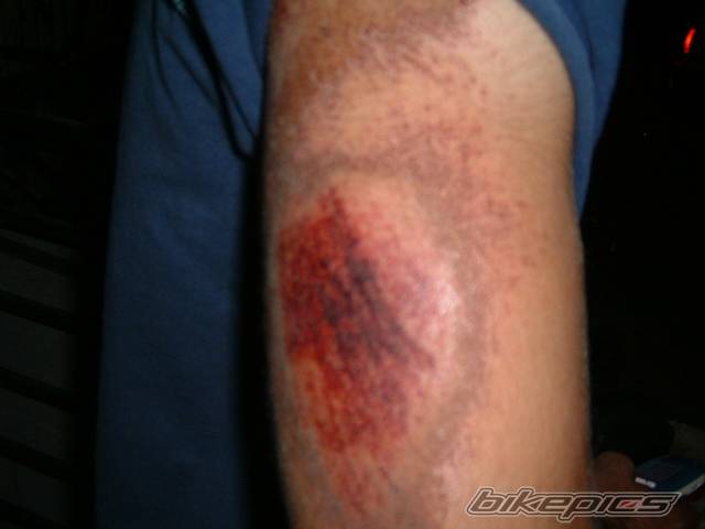 Bike Photo 310071