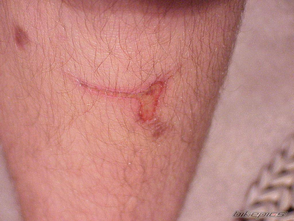 Photo 44222