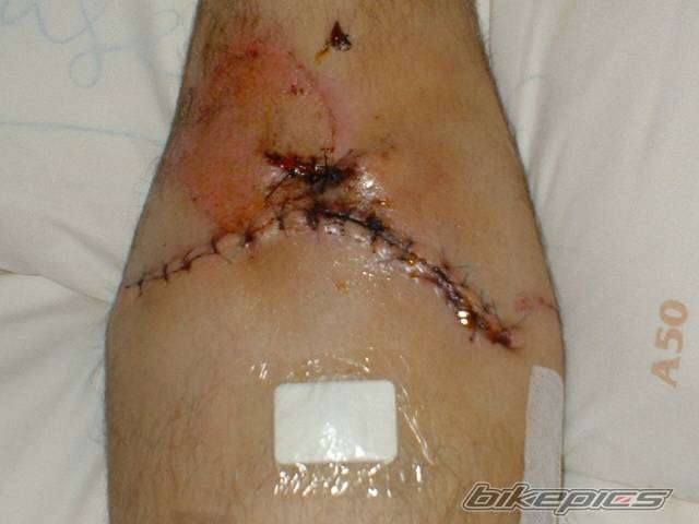 Photo 457525