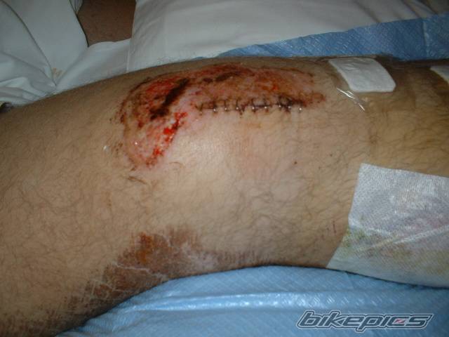 Photo 457528