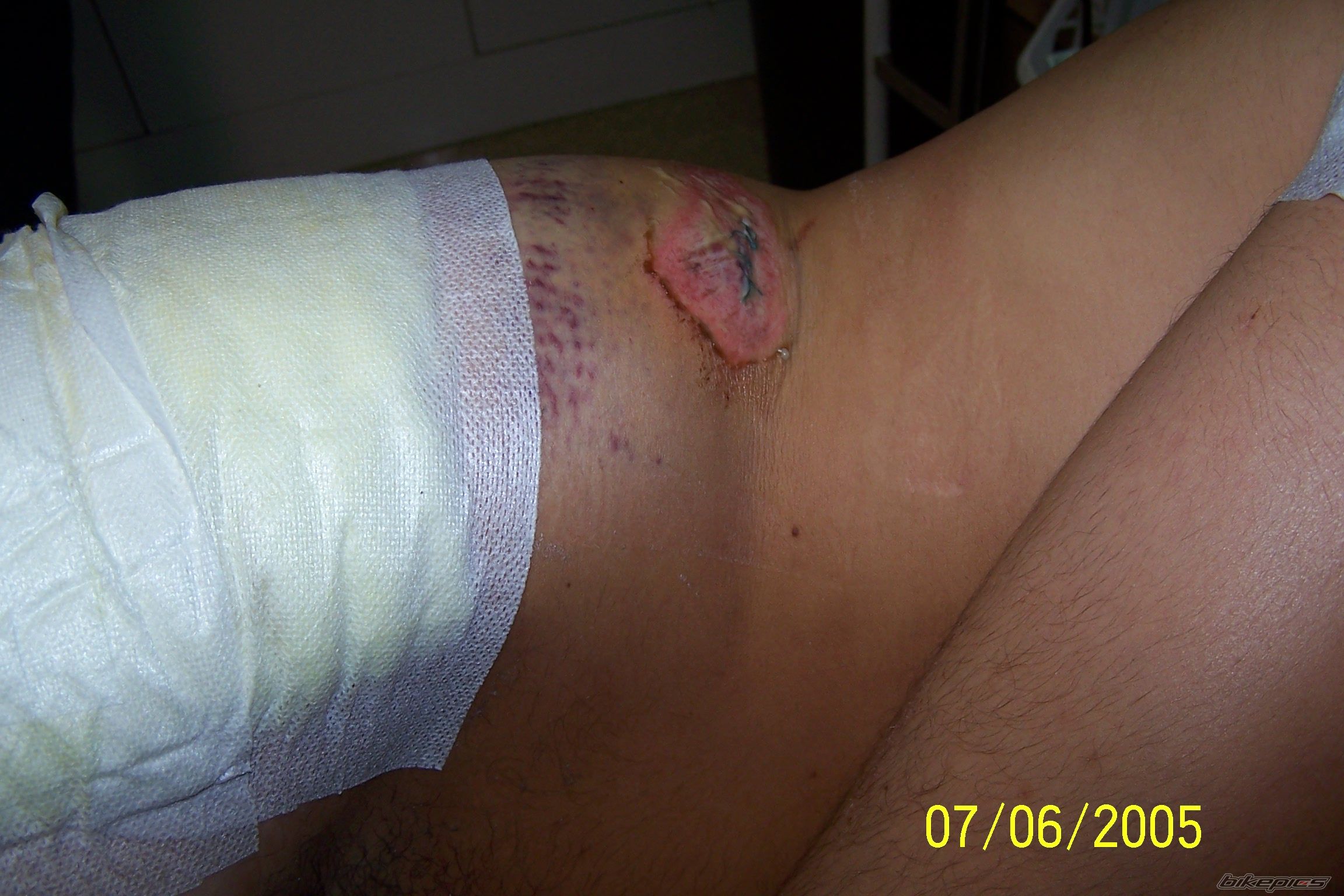 Photo 777336