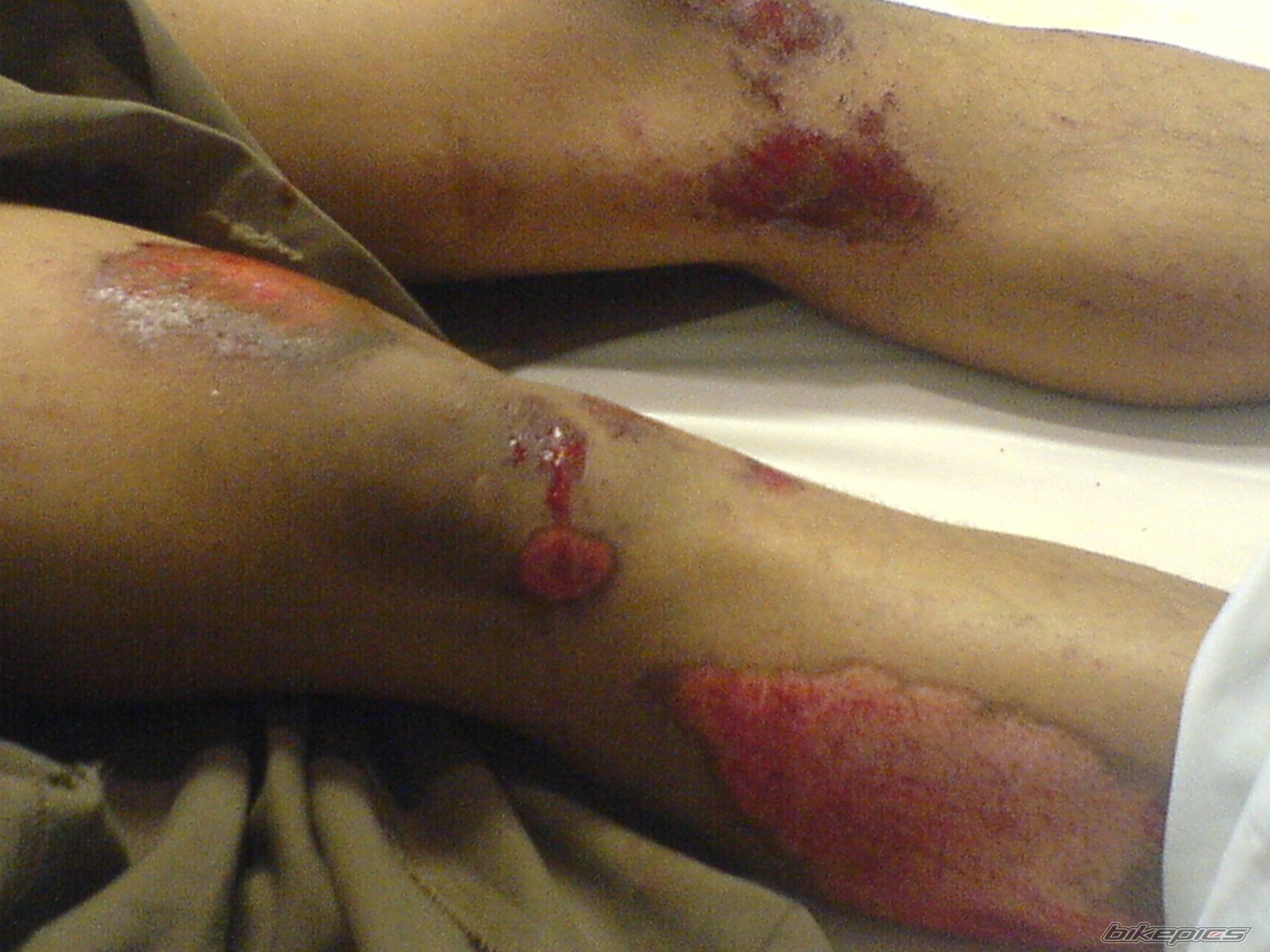 Bike Photo 920568